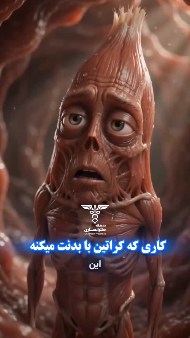 استوری 1